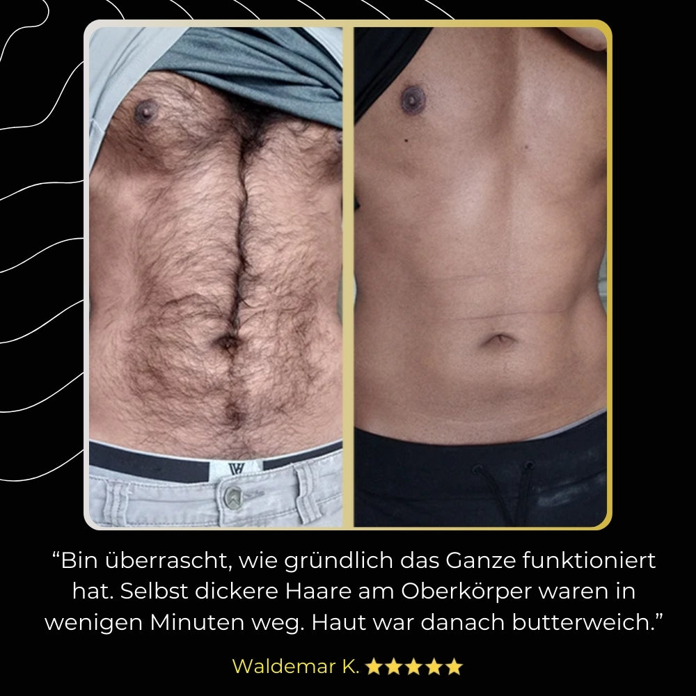 ManeMen – ZeroHair für schnelle & gründliche Haarentfernung (1 + 1 GRATIS)