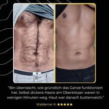 ManeMen – ZeroHair für schnelle & gründliche Haarentfernung (1 + 1 GRATIS)