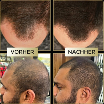 ManeMen - ColorMagic für selbstbewusstes & dichtes Haar